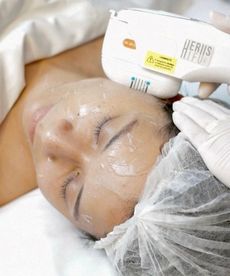 Estética Facial